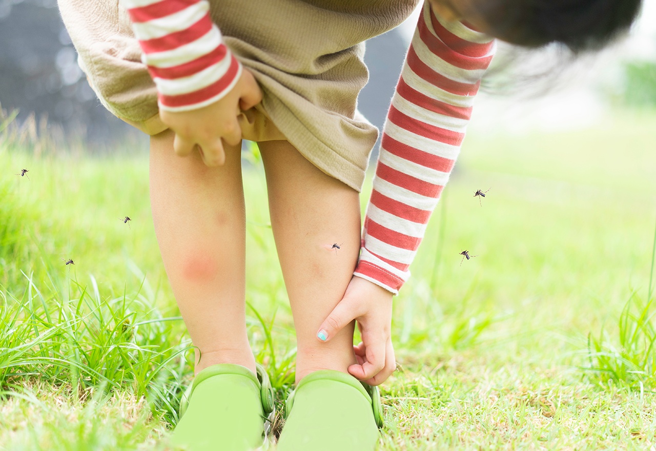 Girl Bug Bite Legs